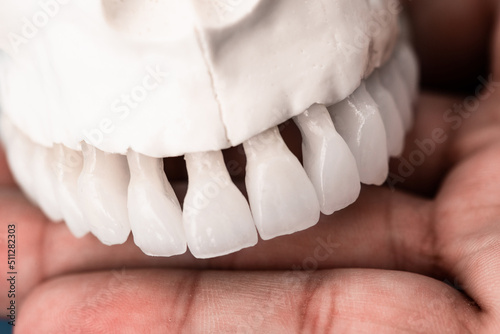 Upper human jaw with teeth anatomy model isolated on blue background. Healthy teeth, dental care and orthodontic medical concept. 