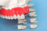Teeth implant and crown installation process parts isolated on a blue background. Medically accurate 3D model. 