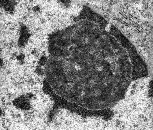 Nucleolus. TEM micrograph photo