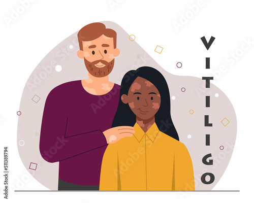 People with skin disease. Vitiligo and health problems, international holiday and medical poster or banner for website. Depigmentation, care and support concept. Cartoon flat vector illustration