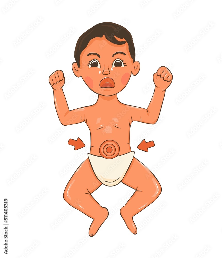 Fototapeta premium Baby bowel ache in cartoon style. Little boy crying