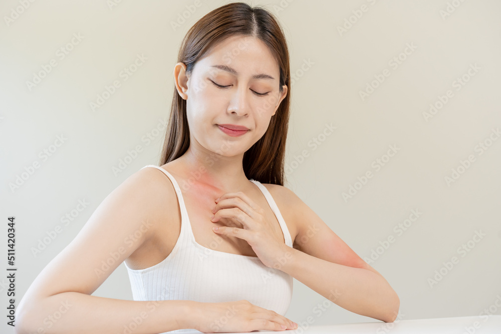 Dermatology, asian young woman, girl allergy, allergic reaction from atopic, insect bites on her body, hand in scratching itchy, itch red spot or rash of skin. Healthcare, treatment of beauty. Dermatology, asian young woman, girl allergy, allergic reaction from atopic, insect bites on her body, hand in scratching itchy, itch red spot or rash of skin. Healthcare, treatment of beauty.