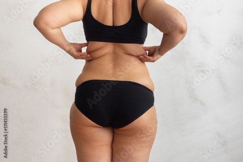 Cropped rearview of fat, adipose, overweight female body in black underwear, checking and holding excess folds, sides on back under shoulder blade. Cellulite friable skin problem. Turgor collagen loss