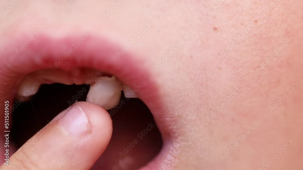 Cropped close up kid mouth, baby teeth problem. Touching by hand finger ...