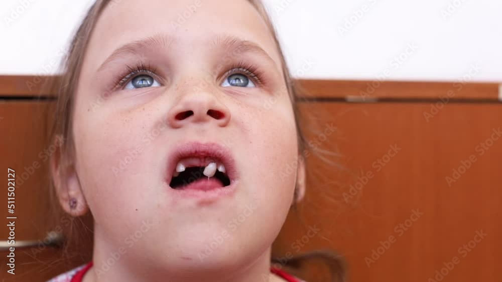 Wideo Stock Little girl with blue eyes looking up, afraid of pain