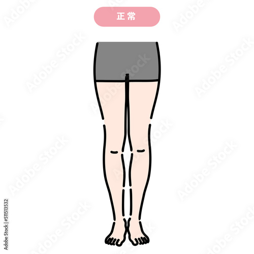 正常な開き方の女性の下半身