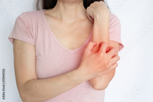 woman are itching and scratching of skin diseases. Concept with Healthcare And Medicine.