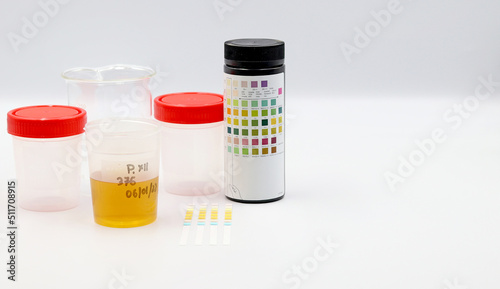 Test Strips for Urine analysis. For People on Alkaline Keto Diets and to Help Monitor Inflammation and other health parameters