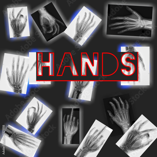 Human hand x ray background vector