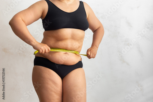 Cropped obese overweight woman with big cellulite sagging abdomen, measuring circumference of waist, belly with yellow roulette tape. Checking size before liposuction surgery. Show off adipose body