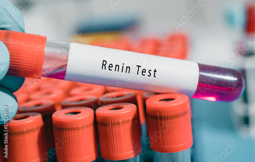 Kidneys Renin and angiotensin Test Controls blood pressure  both directly and also by regulating aldosterone production from the adrenal glands photo