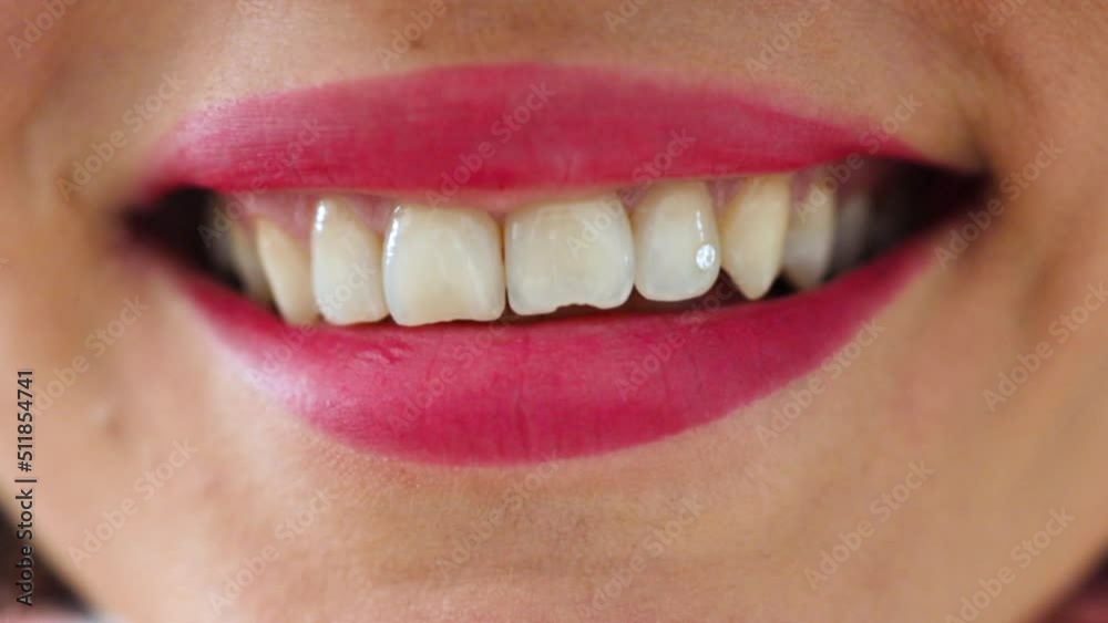 Smile of a woman with not perfect white teeth close up. Uneven teeth with diamond stone Smile of a woman with not perfect white teeth close up. Uneven teeth with diamond stone