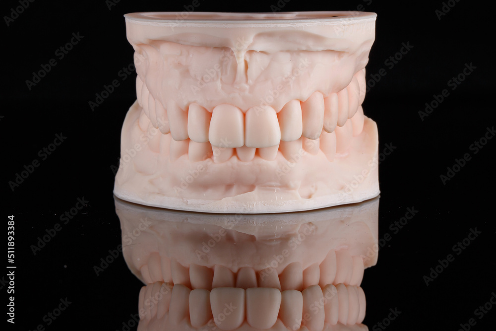 printed dental model of the upper and lower jaws in the bite on a 3D