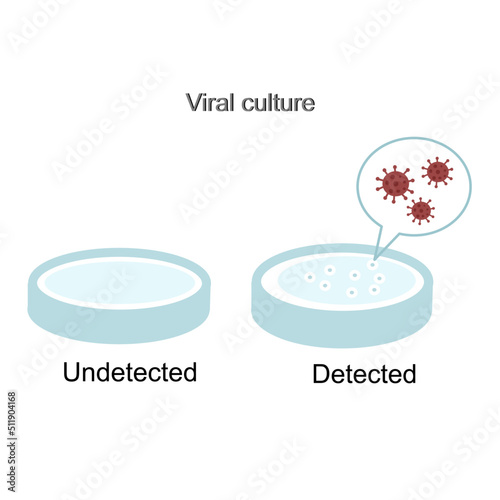 The result interpretation of viral culture for diagnosis the pathogen infection : Detected and undetected