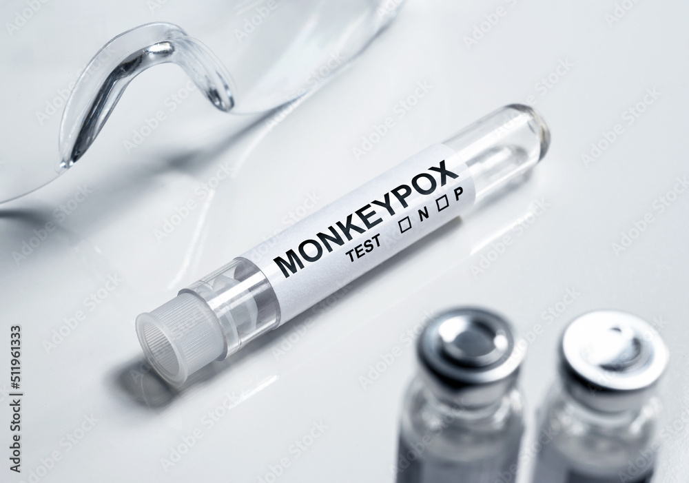 Monkey pox test tube on medical desk, monkeypox virus diagnosis concept ...