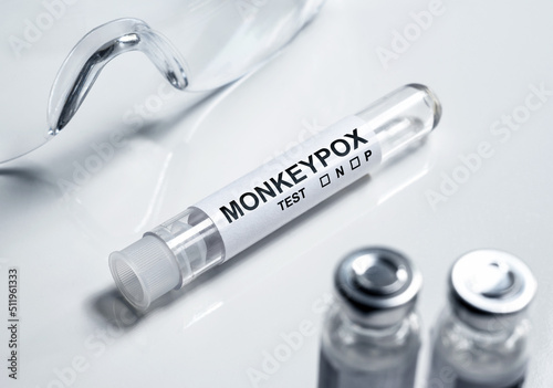 Monkey pox test tube on medical desk, monkeypox virus diagnosis concept photo