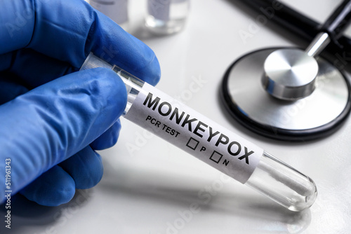 Monkeypox PCR test tube in doctors hand, medical kit for monkey pox virus diagnostics photo