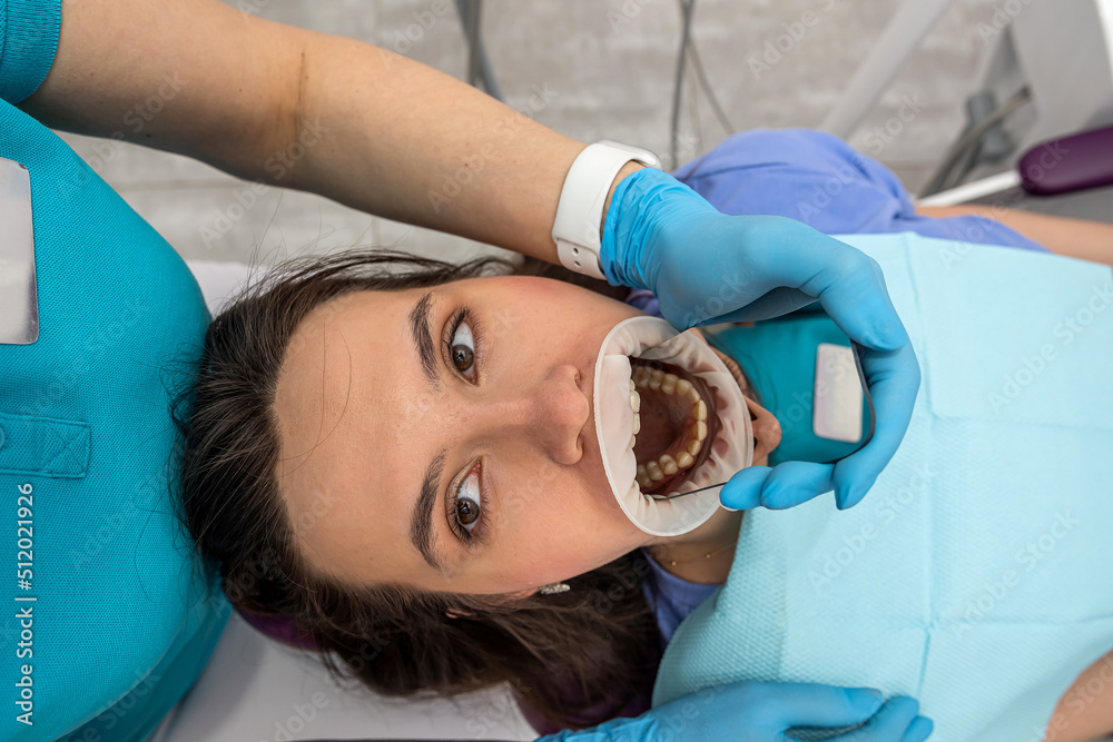 The orthodontist uses an intraoral scanner to scan the patient's teeth. The orthodontist uses an intraoral scanner to scan the patient's teeth.