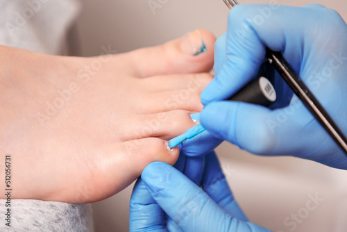 A master pedicurist paints the client s toenails. Person s big toe with titanium thread for correction of ingrown toenail. Close-up. The concept of podology and chiropody