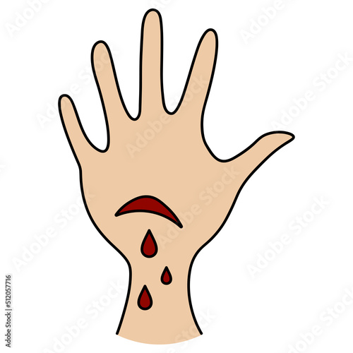 A cut on the palm of the hand. Drops of blood drip from the wound. Color vector illustration. The patient cut himself. Isolated background. Cartoon style. Medical theme. 