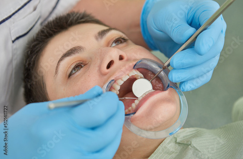 Close up of patient with cheek retractor in mouth receiving dental treatment.