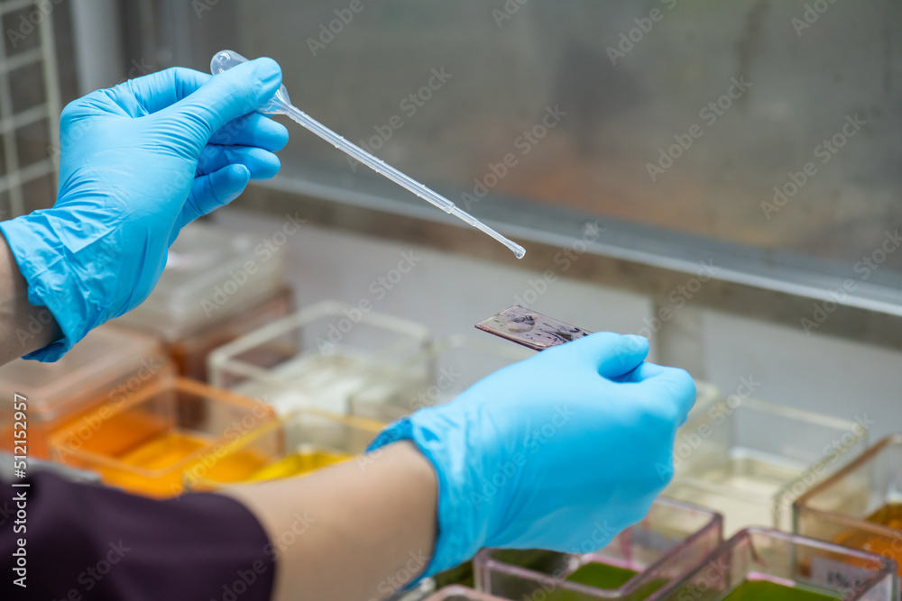 Medical scientists are preparing cytology specimens to detect ...