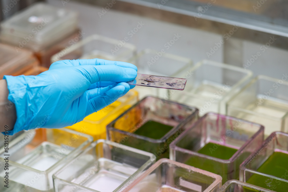 Medical scientists are preparing cytology specimens to detect ...