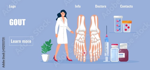 Rheumatoid arthritis of the foot. Tiny doctors treat rheumatism, osteoarthritis, gout, make ultrasound, x ray. World arthritis day in October.