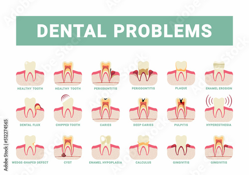 dental problems. infografic template with damaged teeth and bad oral breath. Vector flat pictures set photo