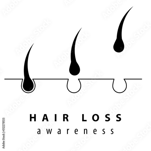 National Hair Loss Awareness Month. Male-pattern baldness, alopecia, thinning hair, alarming levels of hair fall. Concept