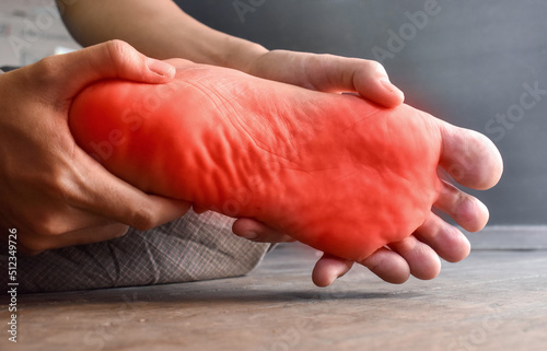 Tingling and burning sensation in foot of Asian young man with diabetes. Foot pain. Sensory neuropathy problems. Foot nerves problems. Plantar fasciitis. photo