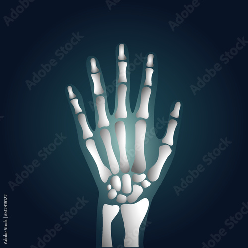 vector illustration of a hand being X-rayed