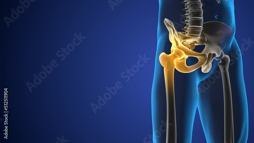 Pain in the hip joint medical background