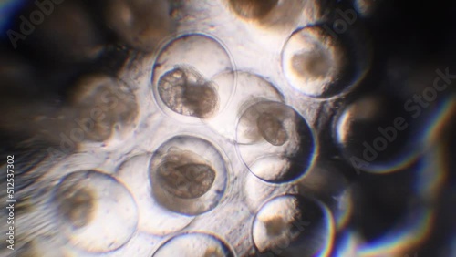 great ramshorn eggs at microscope, Planorbarius corneus eggs, ram's horn snails, photo