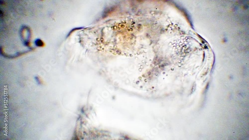 Vorticella, protozoa, phylum Ciliophora , microscopic freshwater organisms,
