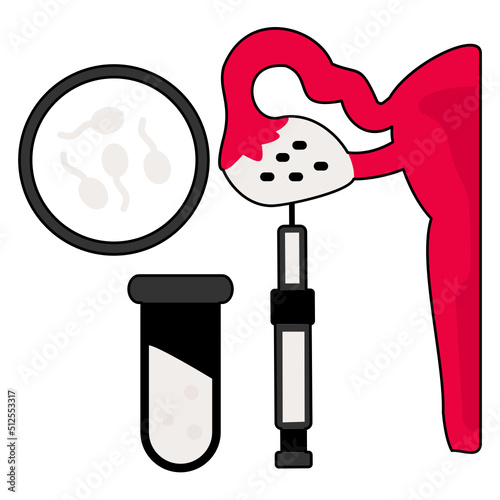 IVF Retrieve eggs Vector color Icon Design, In Vitro Fertilization Symbol, Pregnancy and obstetrician Sign, test tube baby procedure stock illustration, Egg Pickup Concept, 