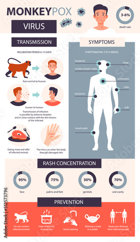 Monkey pox infographic. Infection, symptoms, prevention of the disease of monkey pox. Flat vector illustration.