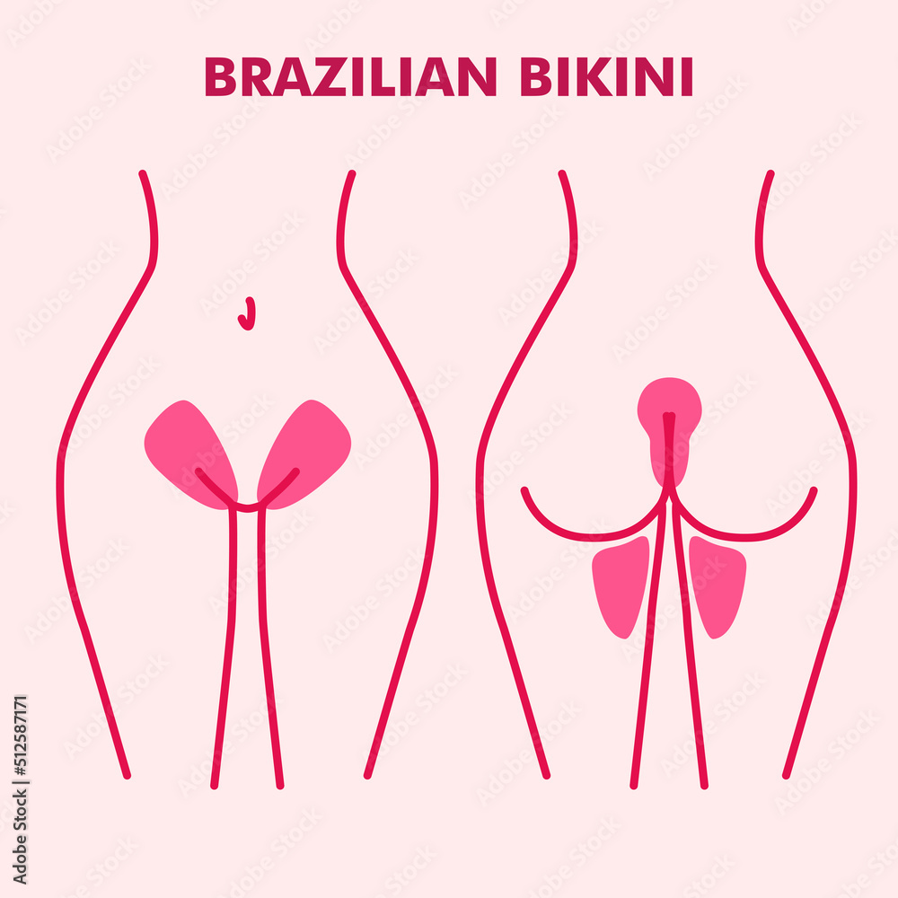 The scheme with areas for hair removal. Brazilian bikini. Female epilation and depilation with wax, sugar or laser. Flat style. Illustration for beauty salons.  Designation of the border hair removal.