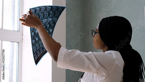 Female doctor examines a brain scan to make a diagnosis and prescribe a treatment plan. The concept of health diagnostics. Magnetic resonance imaging