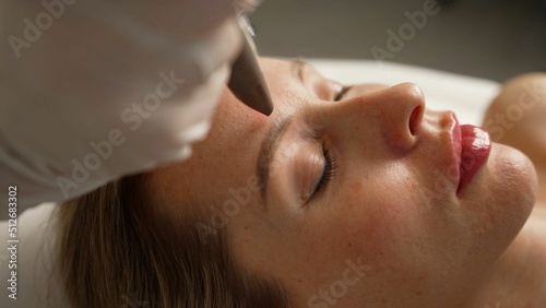 Therapist beautician makes a laser treatment to young woman's face at beauty SPA clinic. Close-up process of laser removal of blood vessels from the skin. Removal of red spots, rosacea, blood vessels