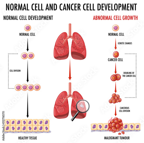 Diagram showing cancer development process