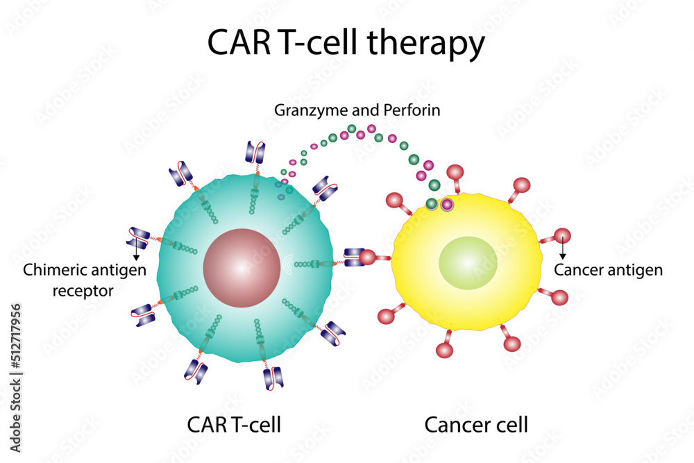 Car t cell therapy and cancer treatment chimeric antigen receptor t