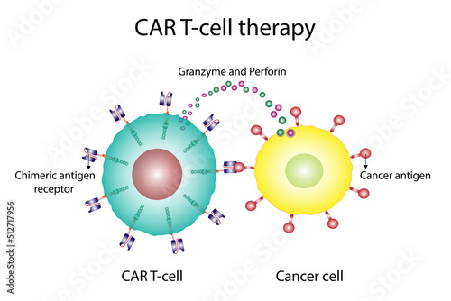 CAR T-cell therapy and Cancer treatment . Chimeric antigen receptor T cells. T cell receptor proteins that have been engineered to kill cancer ells. CAR T cells immunotherapy. Cancer therapy. Vector