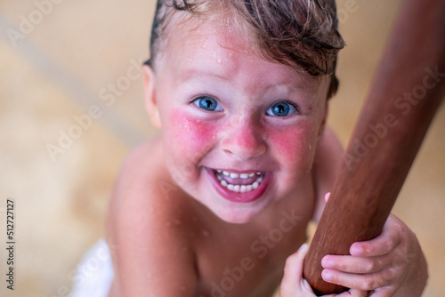 A blue-eyed child with sunburned red cheeks and blue eyes. A little cute girl on the beach smiles