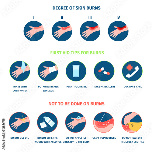 Skin burn stages infographics and treatment. Thermal burns types, burning hands and medical care. Safety of fire, body skin first aid an injury recent vector poster
