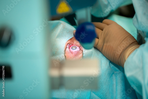 Eye surgery. Surgery to improve vision. Doctor surgeon performs cataract surgery, treatment of myopia. Hospital staff in the operating room. photo