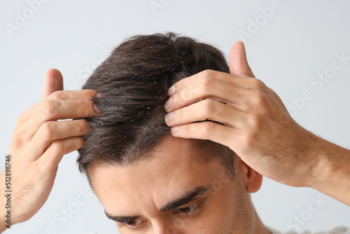 Young man with problem of dandruff on light background, closeup photo