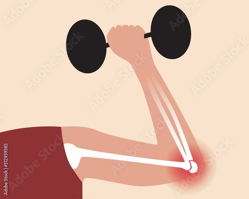 Injury and elbow pain in athlete with dumbbells, flat vector stock illustration with joint disease