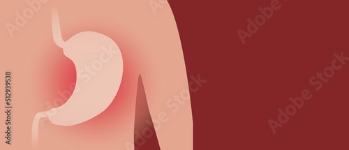 Stomach disease, copy space pattern, anatomical vector stock illustration with persona and gastritis disease