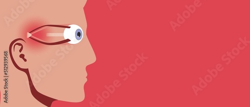 Blindness disease, copy space pattern, anatomical vector stock illustration with persona and fibroid disease, glaucoma